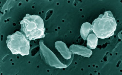 Bacillus odysseyi spores taken by a field-emission environmental SEM and magnified by 10^7